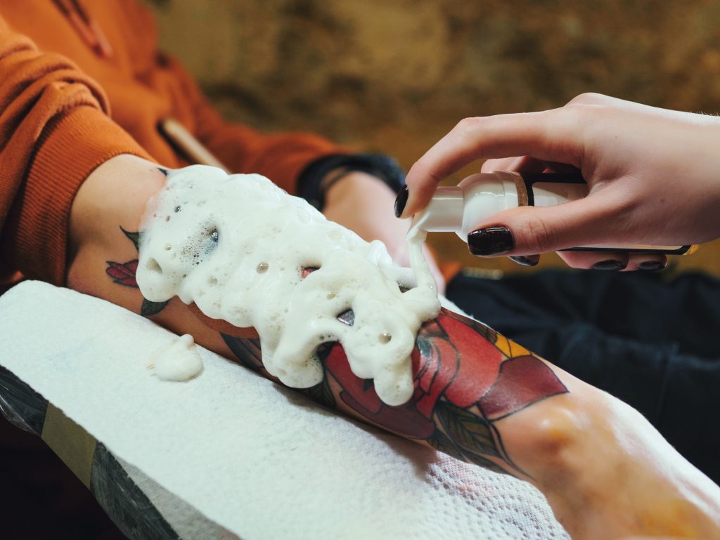 Antiseptic foam wiped off hand during final stage of laser tattoo removal treatment.