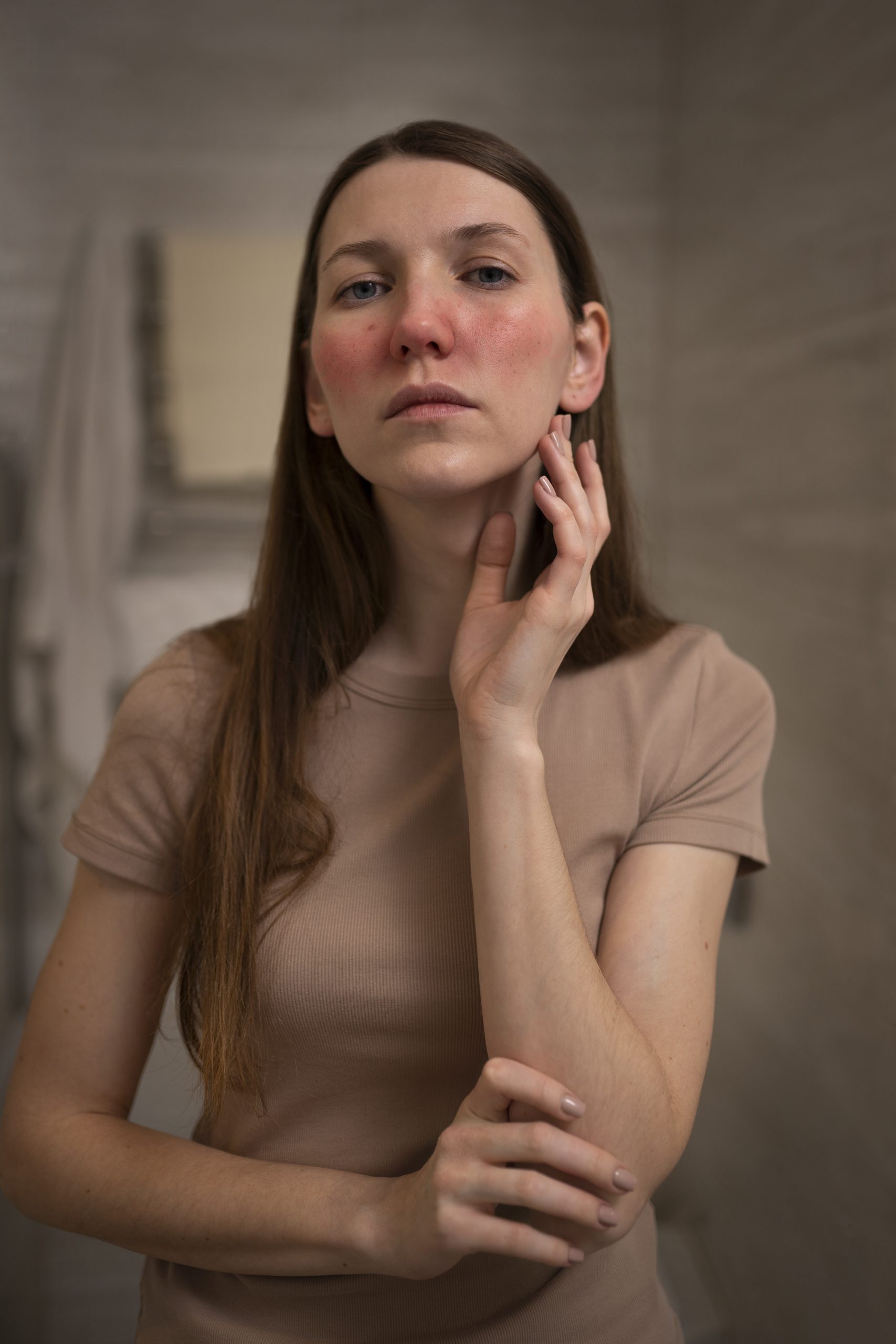 Acne and acne scar treatment in Dubai at Elite Style Polyclinic