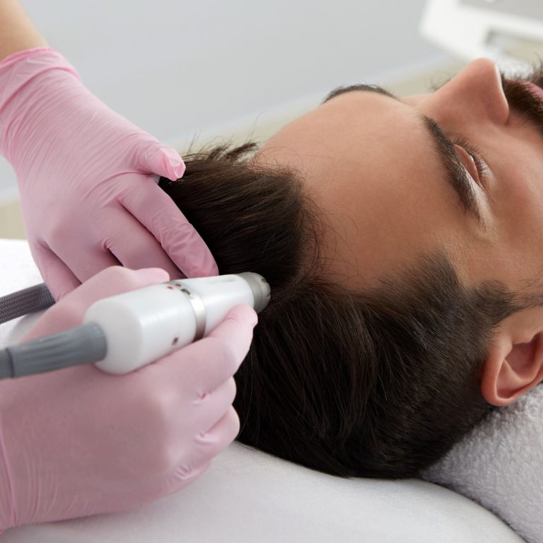 HairScience_Non-ablative-laser-hair-loss-treatment-scaled