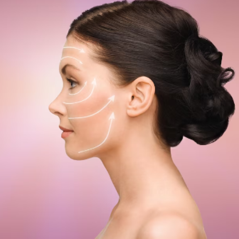 Skin Tightening with Forma